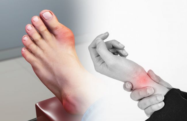 mujer-dolor-manos-piernas