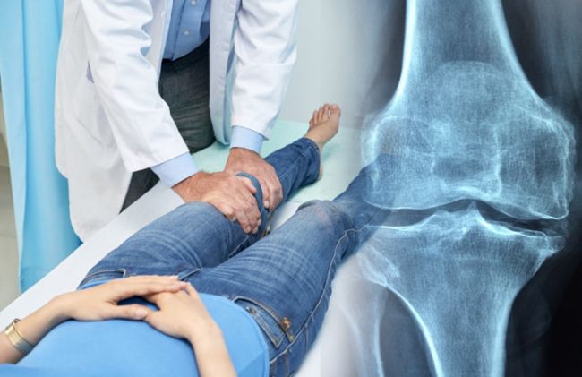 piernas-radiografia-rodilla