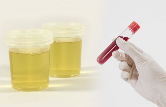 analisis-sangre-orina