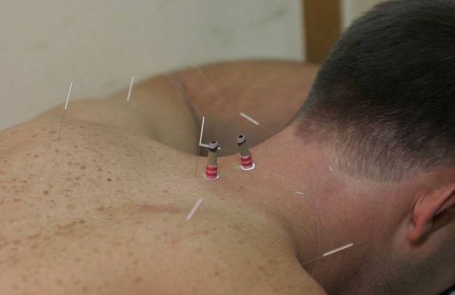agujas-espalda