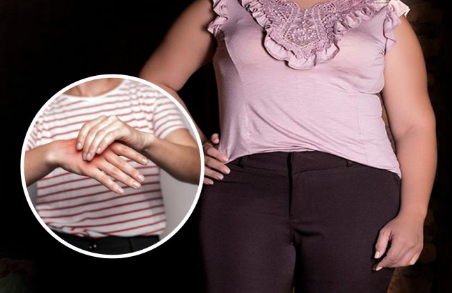 mujer-mano-inflamada