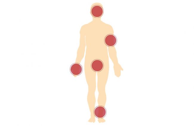 puntos-dolor-cuerpo