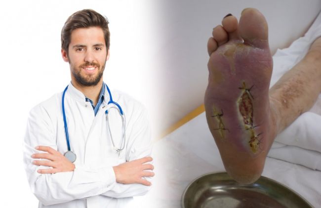 doctor-pie-diabetico