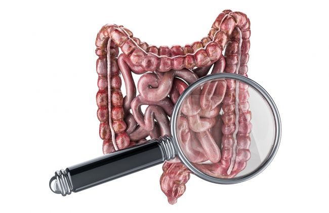 intestinos-lupa