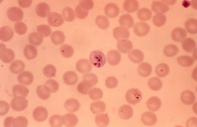 globulos-rojos-palidos