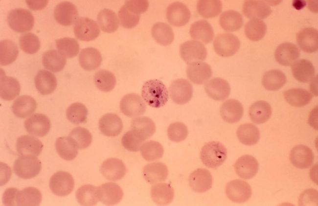 globulos-rojos-palidos