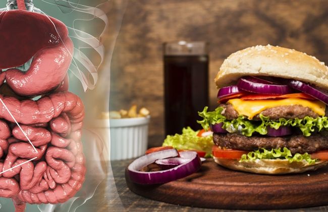 intestinos-gaseosas-hamburguesas
