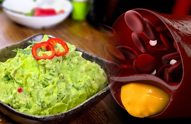 guacamole-arterias-grasa
