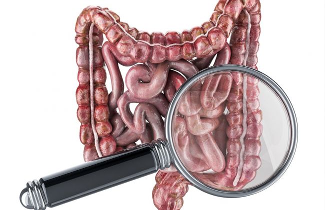 intestinos-lupa
