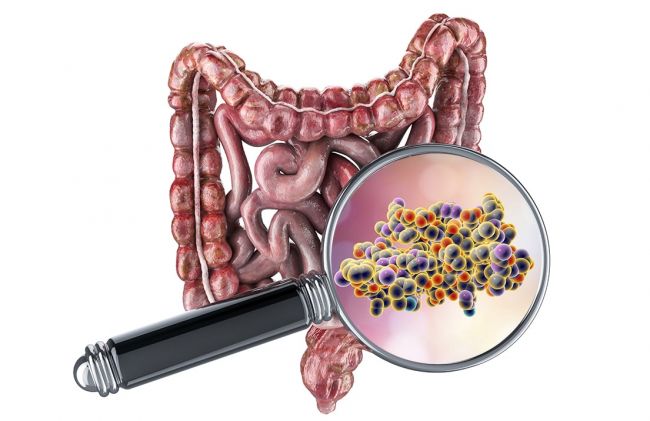 intestino-contaminado