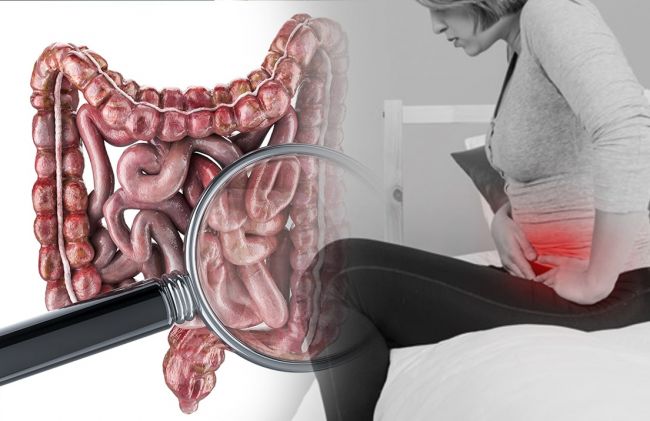 intestino-dolor-panza