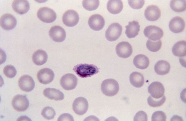 globulos-rojos-palidos