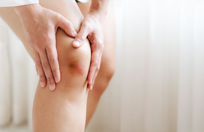 moretones-rodilla