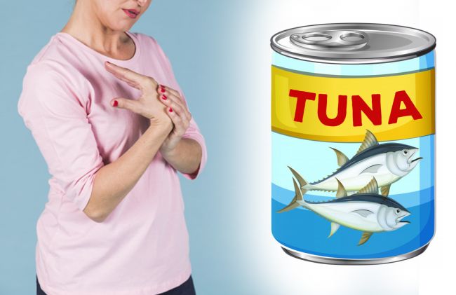 dolor-mano-lata-atun