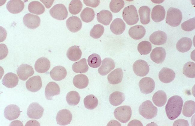 globulos-rojos-palidos