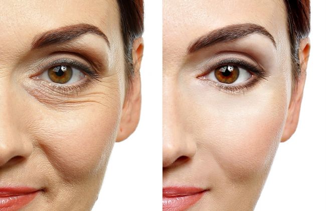 mujer-arrugas-sin-arrugas