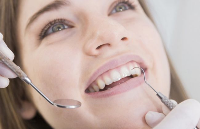 mujer-dientes-blancos