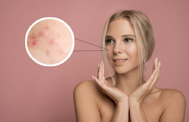 mujer-erupcion-piel