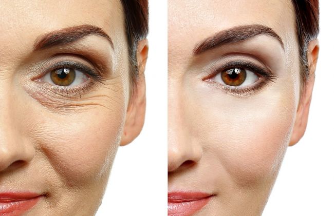 mujer-piel-arrugas-mujer-piel-sin-arrugas