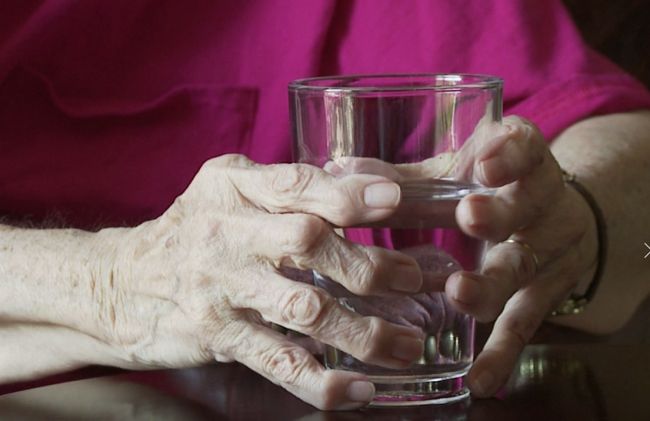 manos-deformadas-vaso