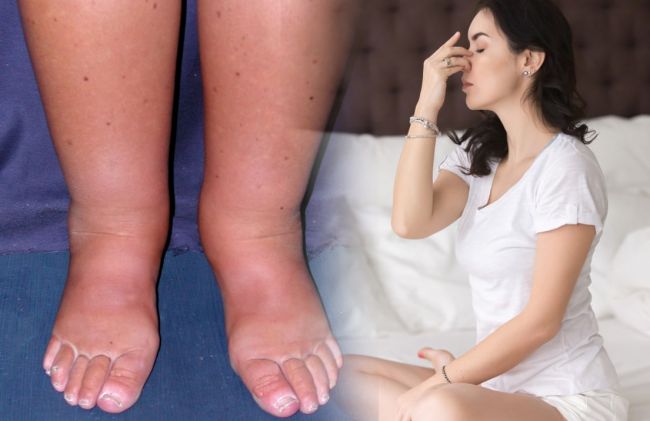piernas-hinchadas-mujer-meditando