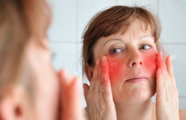 mujer-irritacion-rostro