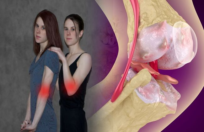 mujeres-gemelas-articulaciones-inflamadas