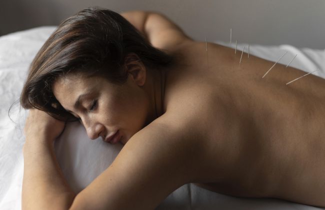 agujas-acupuntura
