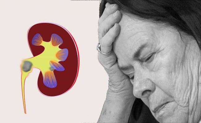 mujer-problemas-renales
