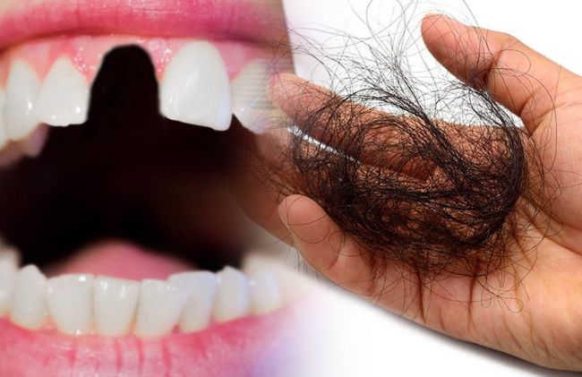 boca-sin-diente-manojo-cabello