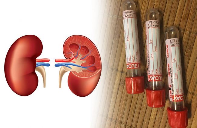 riniones-tubos-ensayo