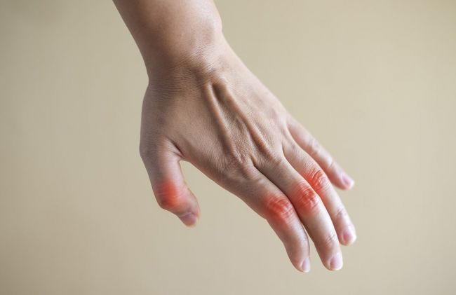 mano-inflamada