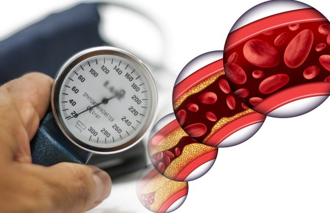 tensiometro-arterias