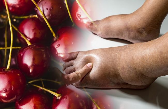 cerezas-agrias-pies-inflamados
