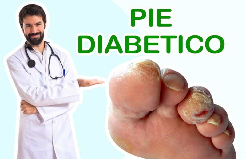 ¿Qué es el Pie Diabético?