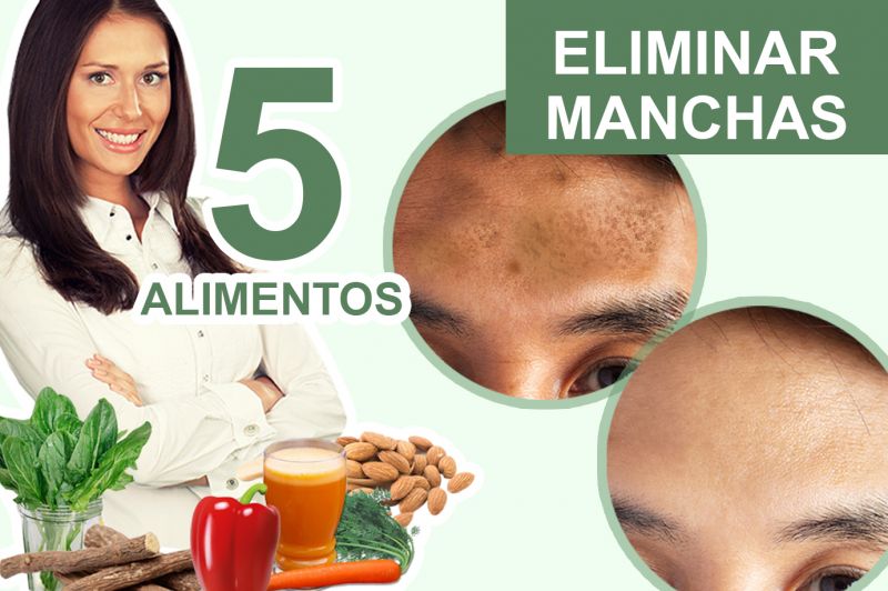 5 Alimentos que ayudan a Quitar las Manchas en la Piel