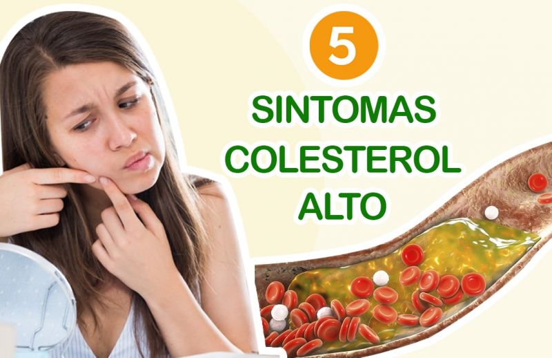 5 Síntomas de Colesterol Alto
