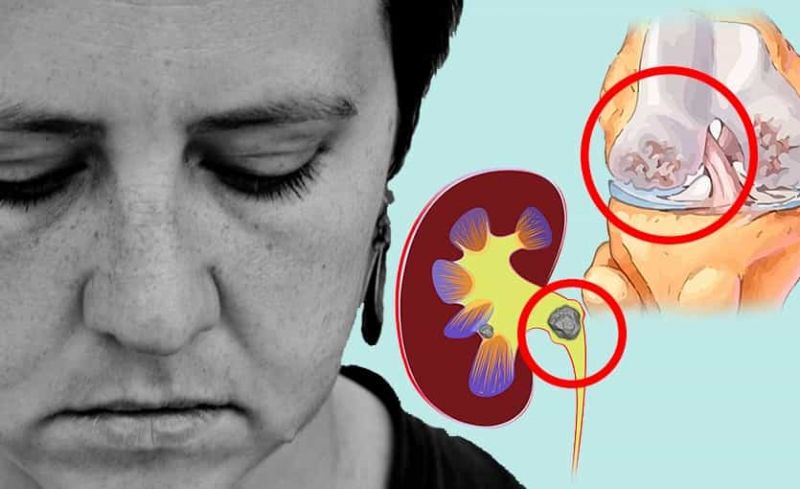 10 Peligrosas enfermedades causadas por la Obesidad que necesitas conocer