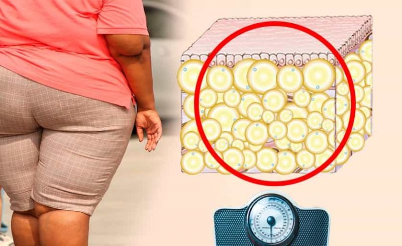 Obesidad: Qué es, Síntomas, Causas,Tratamiento Natural y Médico