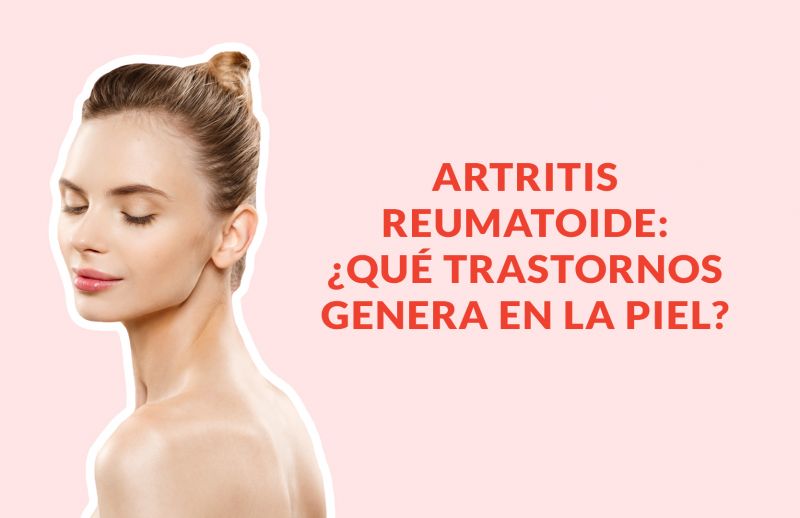 Artritis Reumatoide: ¿Qué trastornos genera en la piel?