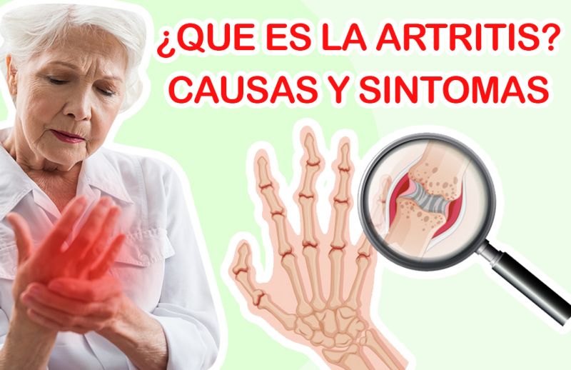 ¿Qué es la artritis? Causas y Síntomas