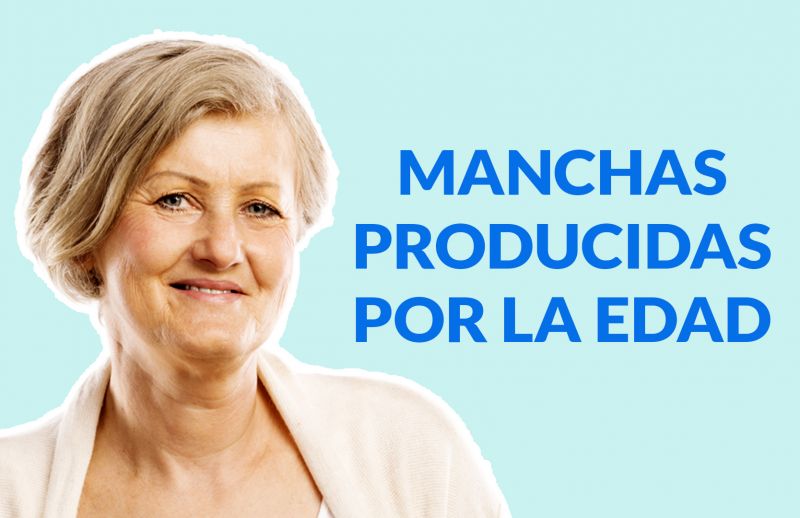 Manchas producidas por la edad: Aprende a tratarlas