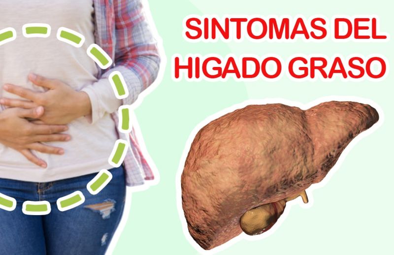 10 Síntomas de Hígado Graso