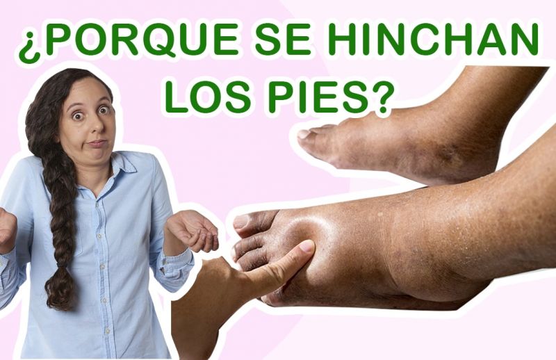 Por qué se hinchan los pies