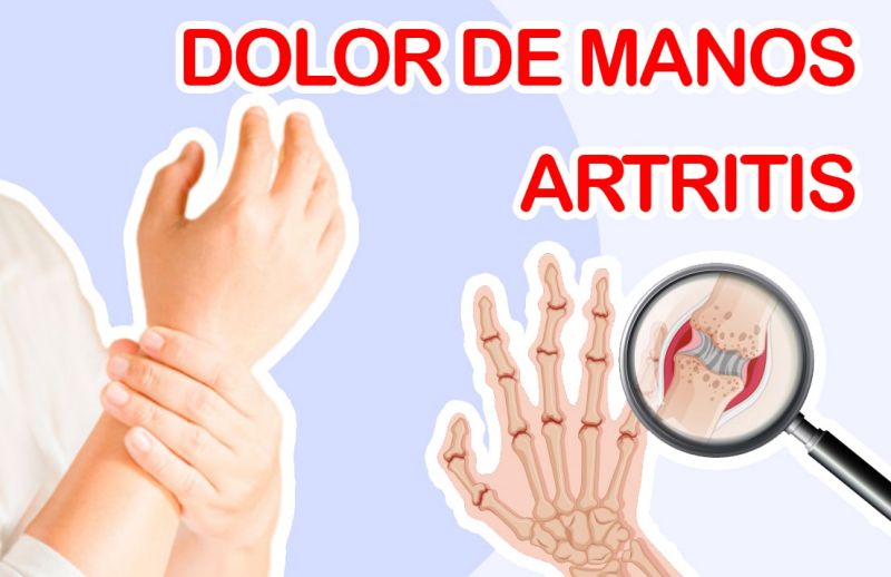 Dolor de Manos y Artritis