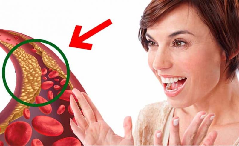 10 Consejos para bajar el colesterol y triglicéridos altos rápidamente