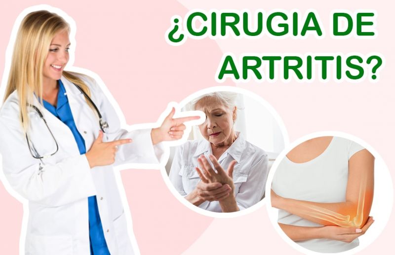 Cirugía de Artritis ¡Lo que debes saber!