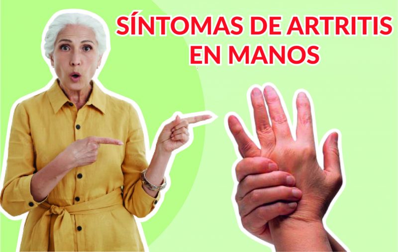 ¿Cómo empieza la artritis en las manos?