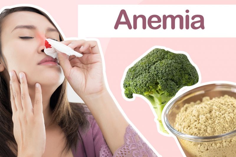 5 consejos para curar la Anemia