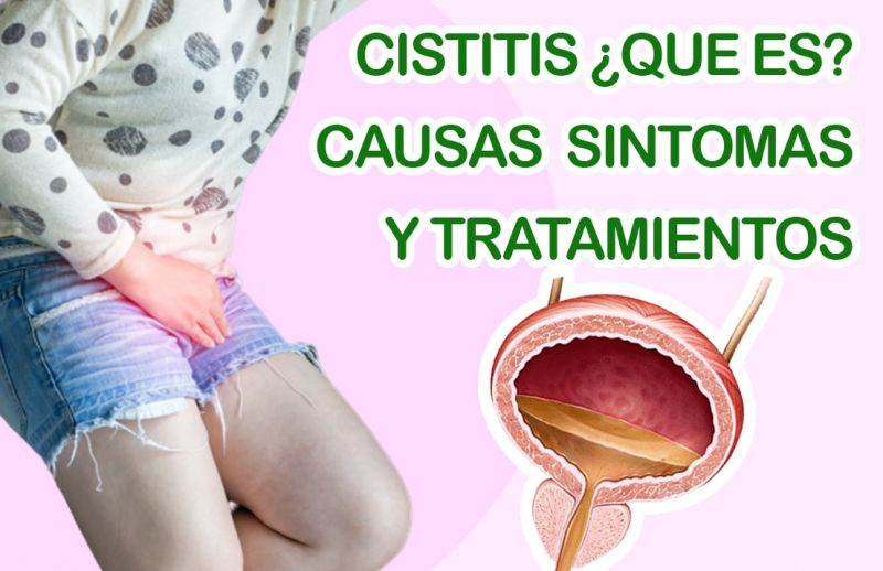 Cistitis: Qué es, causas, síntomas, remedios y Tratamiento